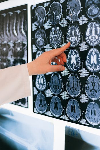 Neuroscience - Using 100% of Your Brain